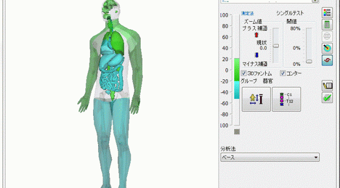 ｱﾑｻｯﾄ　後　加工